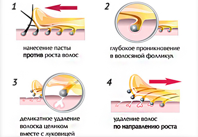 шугаринг