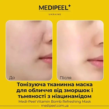 Маска Medi-Peel Vitamin Bomb освежающая для лица с витаминным комплексом - Фото №2