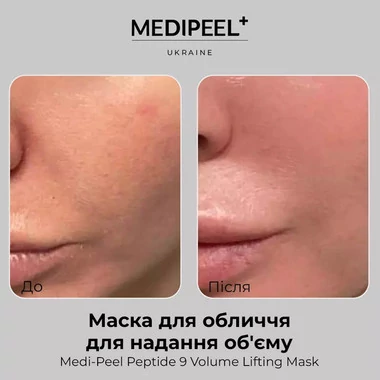 Маска тканевая MEDI-PEEL  для лица с эффектом лифтинга Peptide 9 Volume Lifting Mask - Фото №2