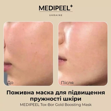 Маска тканевая MEDI-PEEL питательная Tox-Bor Gold Boosting Mask 25 мл - Фото №2