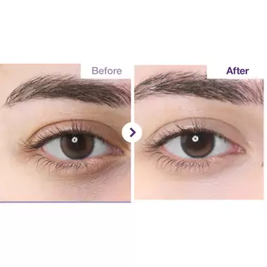 Крем для кожи вокруг глаз с ретинолом и пептидами No.9 NAD+ Retinol Volumetox Eye Cream, 10 мл - Фото №5