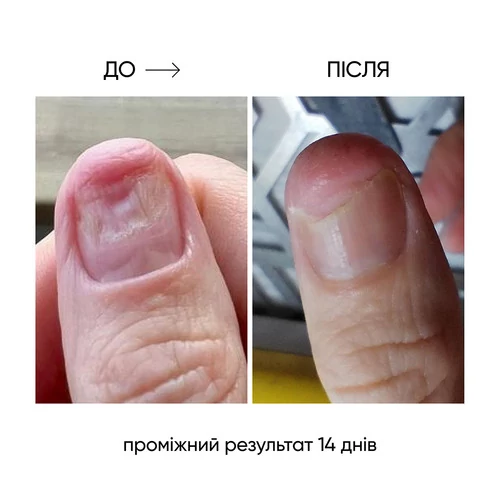 Регенерирующее масло NAILS OF THE DAY OniStop против онихолизиса 15 мл (u0000016061) - Фото №3
