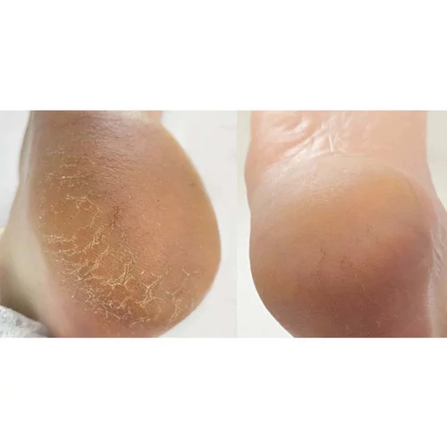 Крем NAILS OF THE DAY от трещин для ног и рук Podology+ 30 мл (НФ-00019547) - Фото №5
