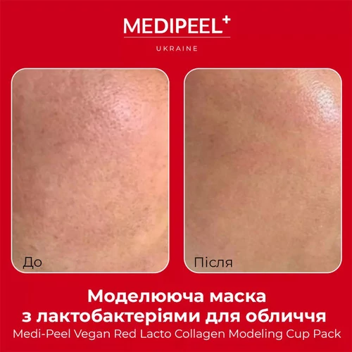 Маска альгинатная Medi-Peel для лица моделирующая с коллагеном и лактобактериями Vegan Red Lacto Collagen Modeling Cup Pack 28г - Фото №3