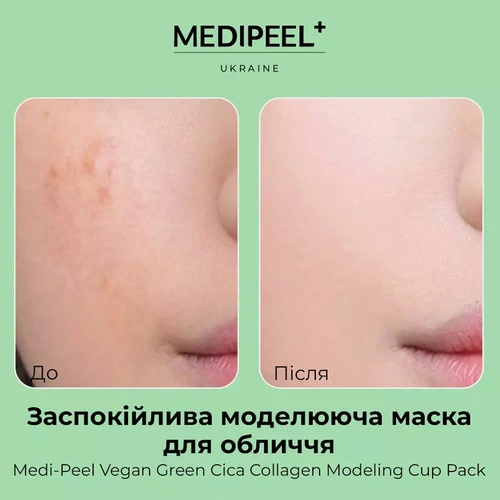 Маска альгинатная Medi-Peel для лица успокаивающая моделирующая с центеллой и коллагеном  Vegan Green Cica Collagen Modeling Cup Pack 28г - Фото №3