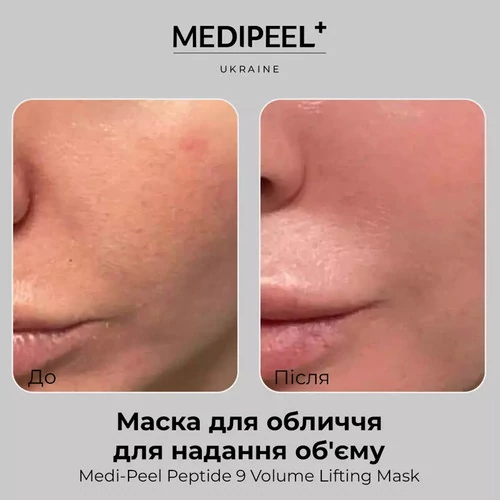 Маска тканевая MEDI-PEEL  для лица с эффектом лифтинга Peptide 9 Volume Lifting Mask - Фото №2